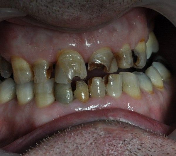 Få dine tænder ordnet hos dygtige tandlæger i Polen